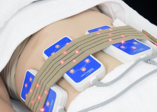 lipolaser